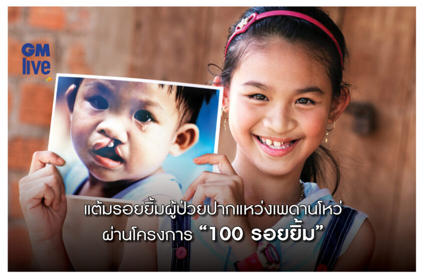  แต้มรอยยิ้มผู้ป่วยปากแหว่งเพดานโหว่ ผ่านโครงการ “100 รอยยิ้ม”