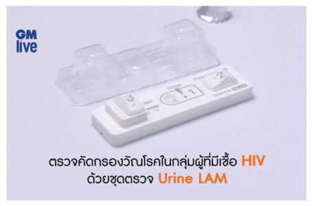 “กำแพงสังคมที่มองไม่เห็น” การตรวจคัดกรองวัณโรคในกลุ่มผู้ที่มีเชื้อ HIV